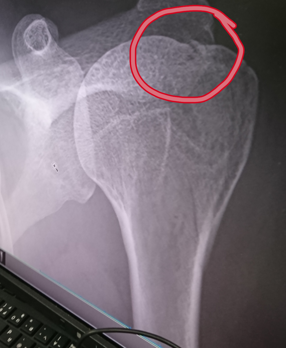 f:id:azu1215:20191012155608p:plain f:id:azu1215:20191012155608p:plain