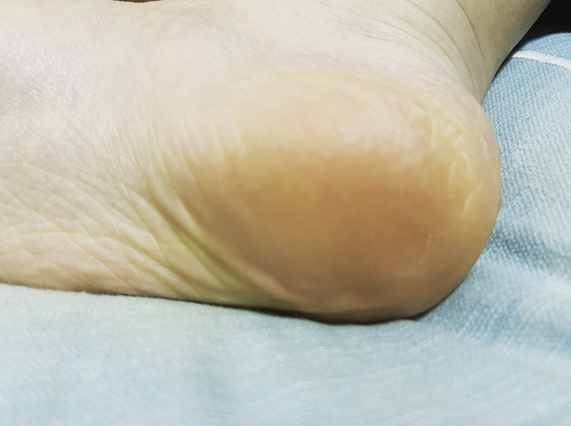 f:id:azuzuzuzu3:20220205225614p:plain