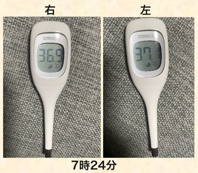 育児記録 乳腺炎になりました ととちゃんブログ ママスマイル