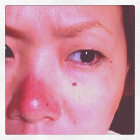 赤っ鼻 バビュー日記