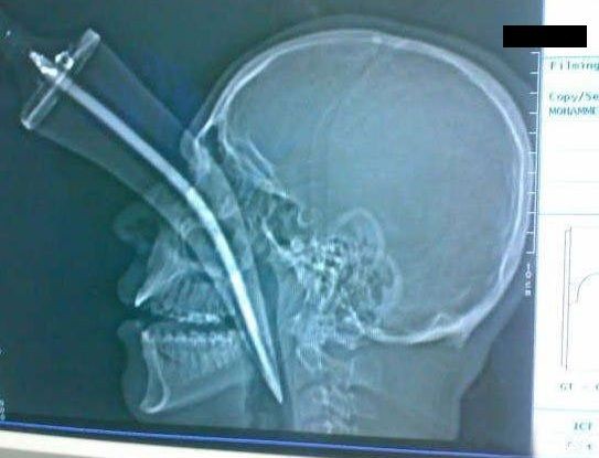 f:id:bakenshikabuya:20120727144845j:image