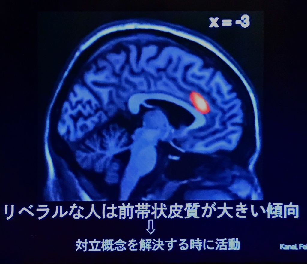 f:id:banocchi:20181012041244j:plain f:id:banocchi:20181012041244j:plain