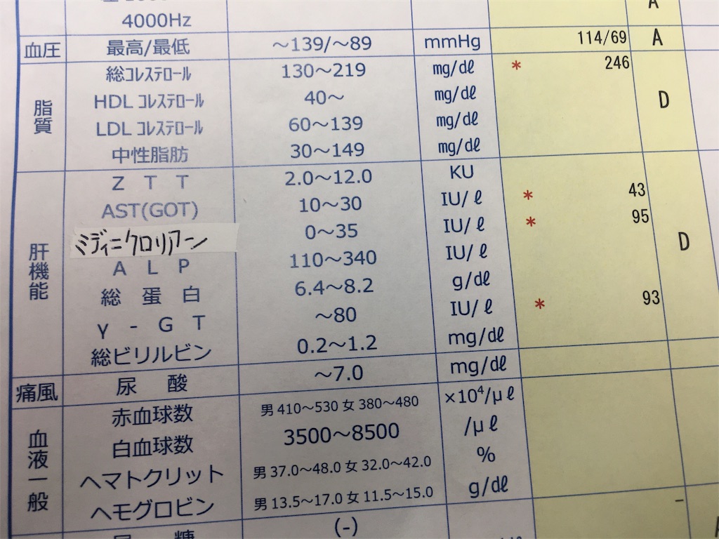 f:id:barzam154:20170814211829j:image