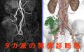 大腸癌のCT angiography　腹部CT