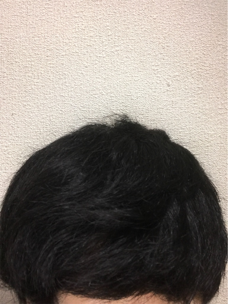 f:id:bbunderdogbb184:20210604231835j:image f:id:bbunderdogbb184:20210604231835j:image