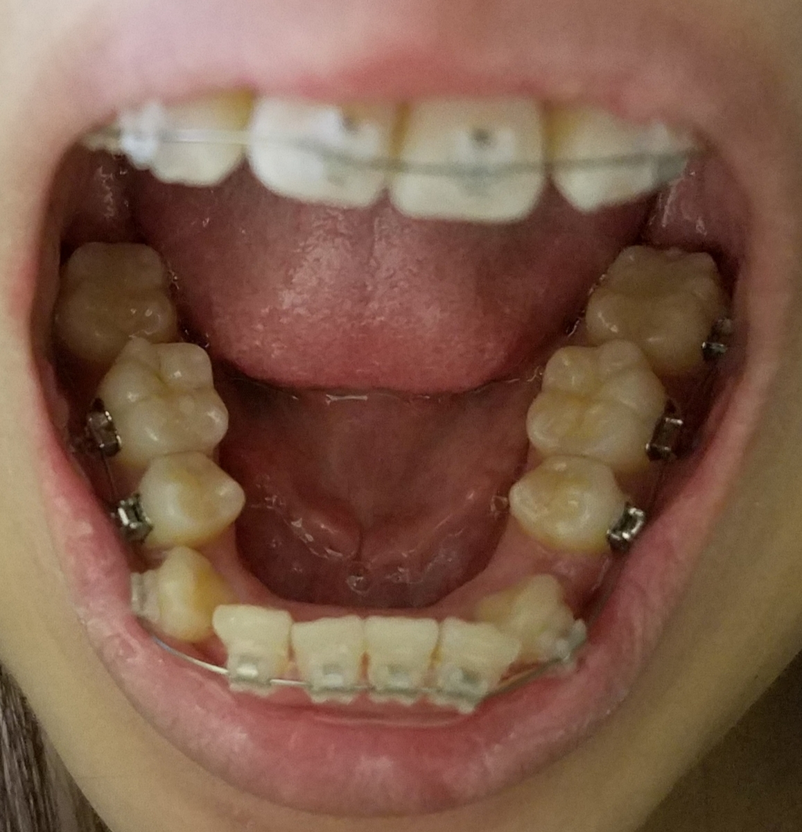 f:id:beenmame2010:20190316005721j:plain