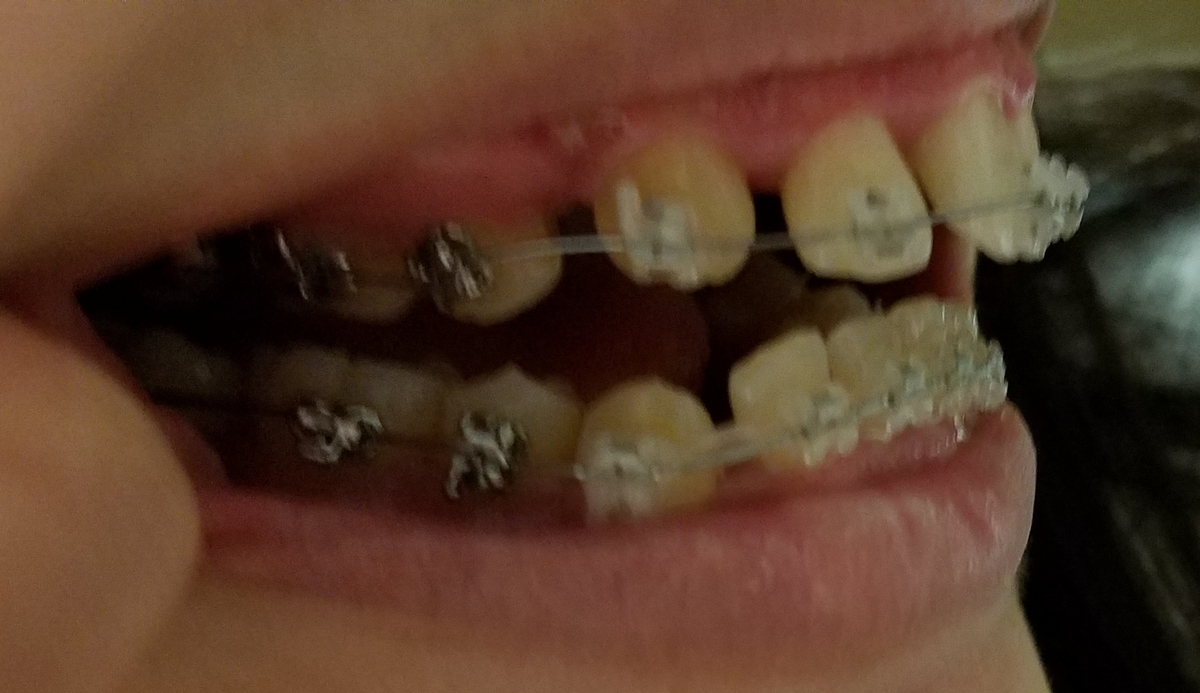 f:id:beenmame2010:20190419134251j:plain