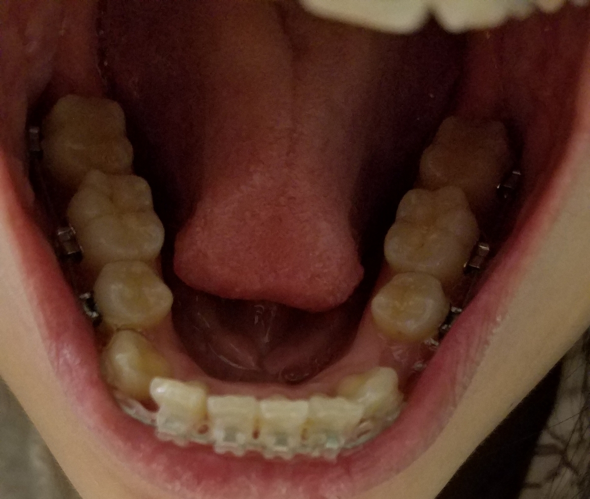 f:id:beenmame2010:20190419134746j:plain