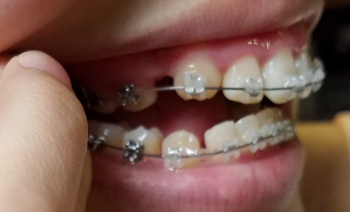 f:id:beenmame2010:20190514073014j:plain