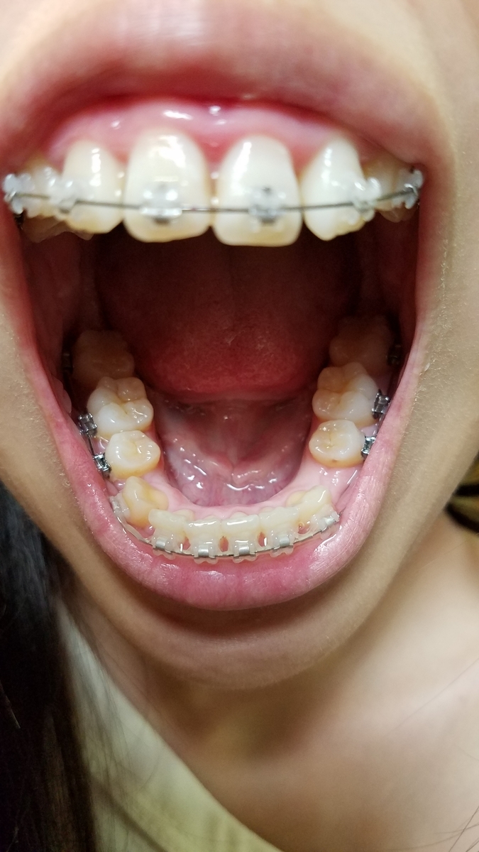 f:id:beenmame2010:20190514073308j:plain