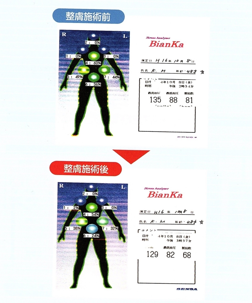 f:id:beglad:20180221160108j:plain