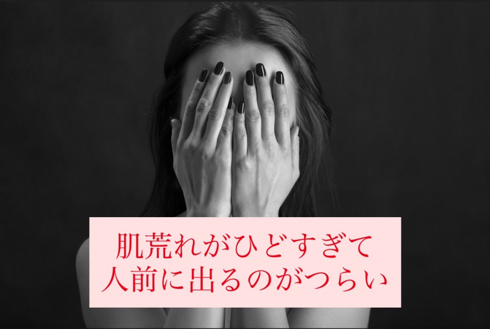 f:id:bekindtourself:20201002211110j:plain