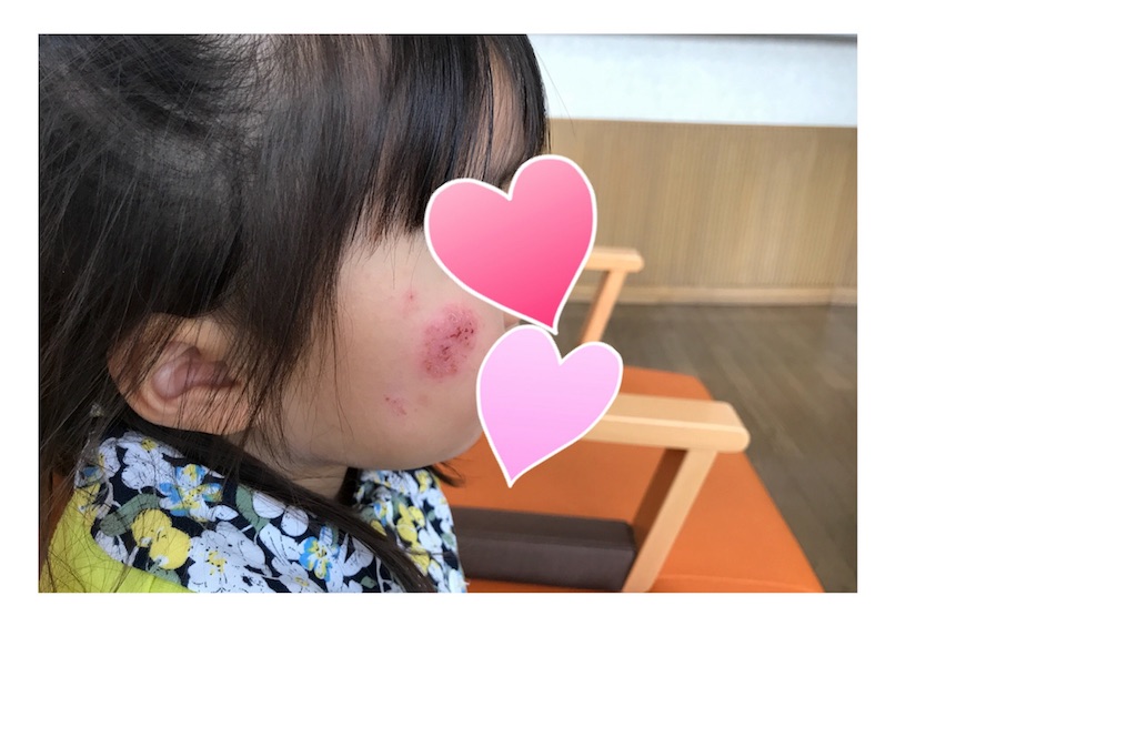 わが家の子供の乾燥対策に使っているもの すきなものだけの簡素な暮らし
