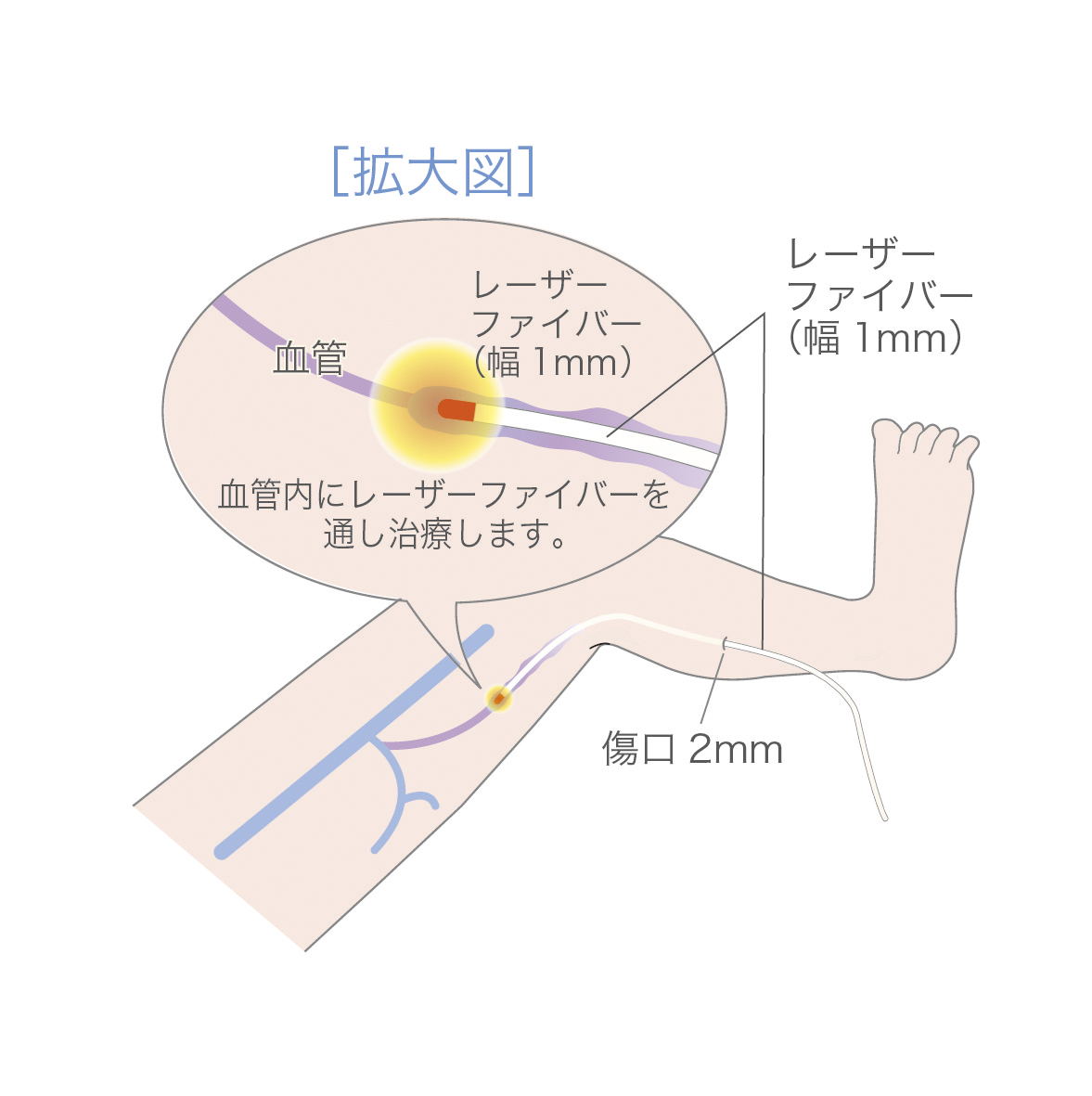 f:id:berry42195:20191002104743j:plain