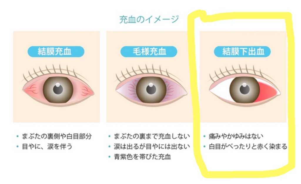 f:id:berry42195:20251122210732j:image