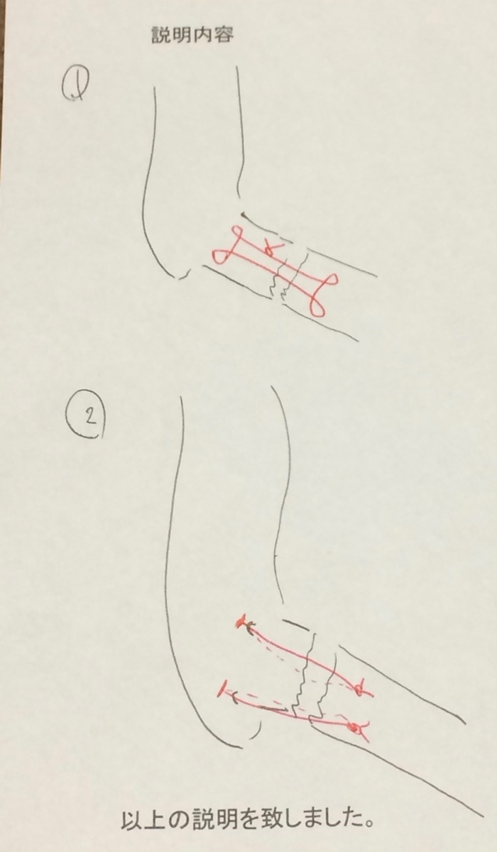 f:id:besmart-chari:20191031222738j:plain