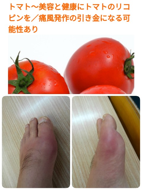 f:id:betebete00:20200325212654j:image f:id:betebete00:20200325212654j:image