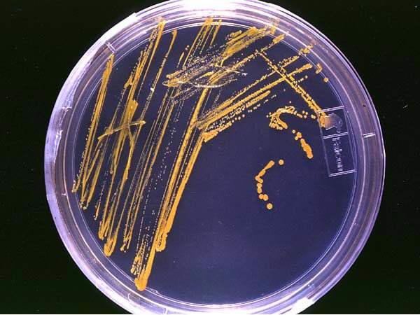 抗生物質ペニシリン発見に至るまでの物語