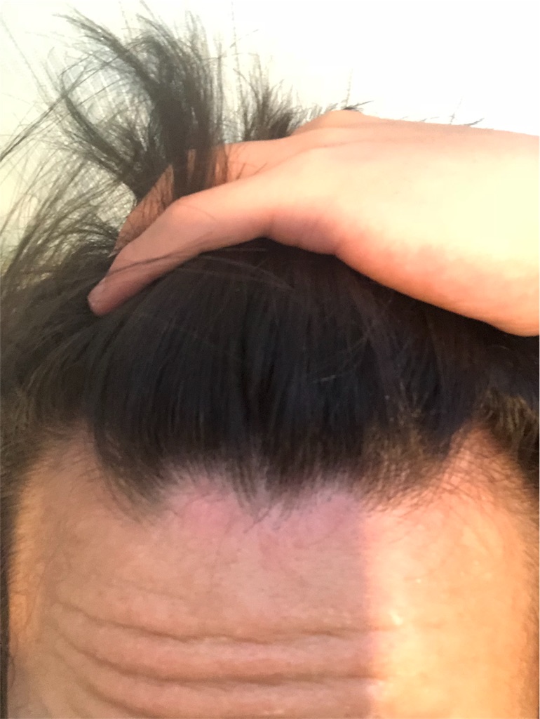 f:id:bighappy7:20180522184312j:image f:id:bighappy7:20180522184312j:image