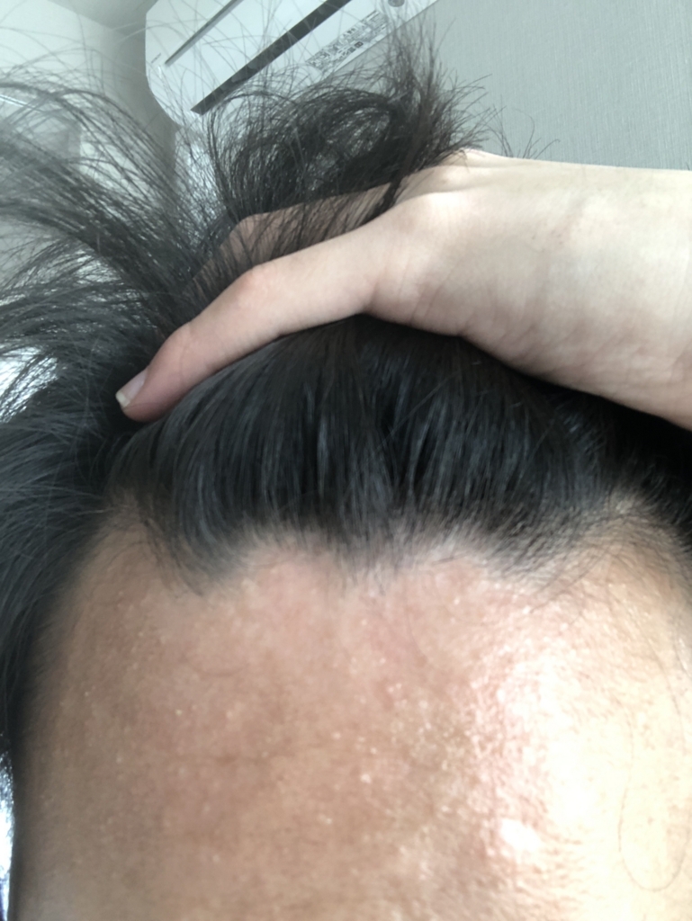 f:id:bighappy7:20180602130414j:plain f:id:bighappy7:20180602130414j:plain