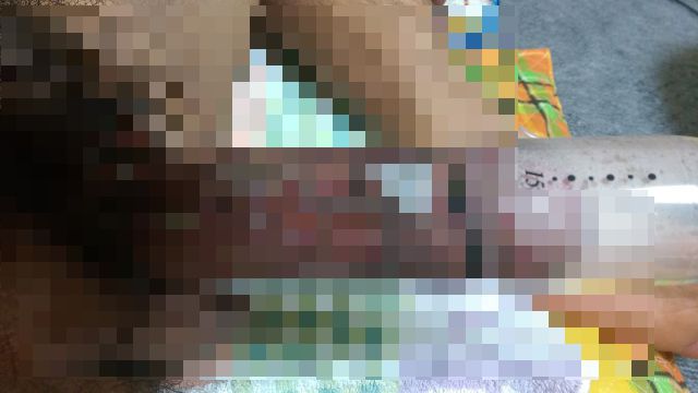 f:id:bigochinchin:20170701192330j:plain
