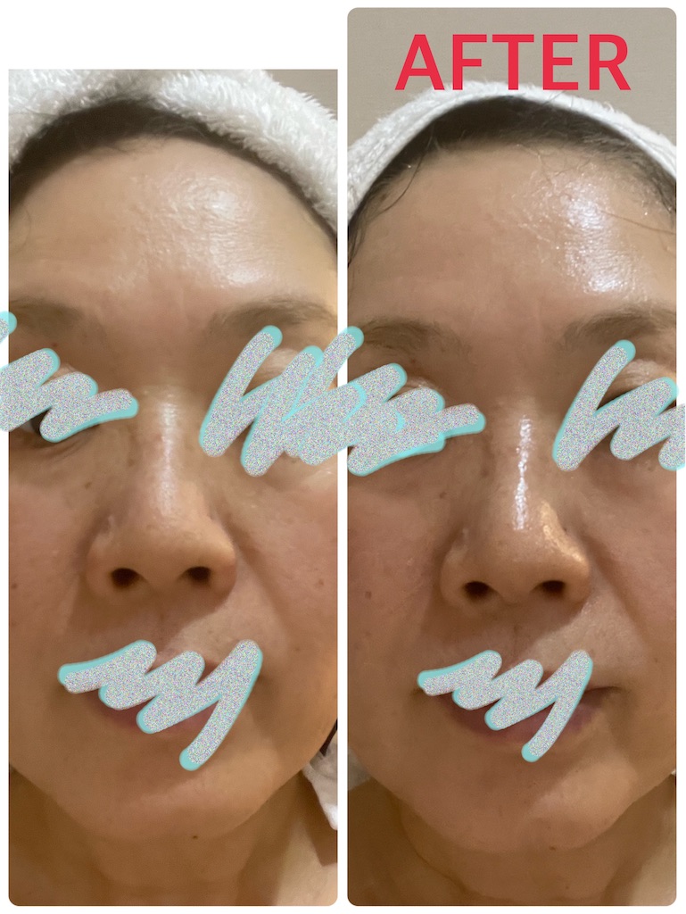 ナインテイルズスピードリフト ナインテイルズ スピードリフト 6ml 2本