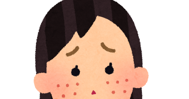 ニキビ 脂性肌が３ヶ月で改善 エテュセ Cセラム が優秀すぎた話 汚肌からの解放