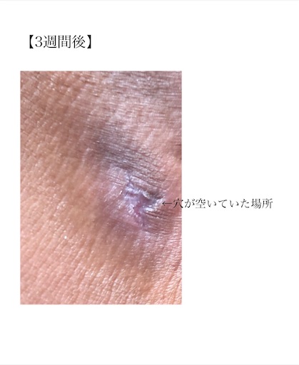 f:id:biwa621:20200615220957j:image f:id:biwa621:20200615220957j:image