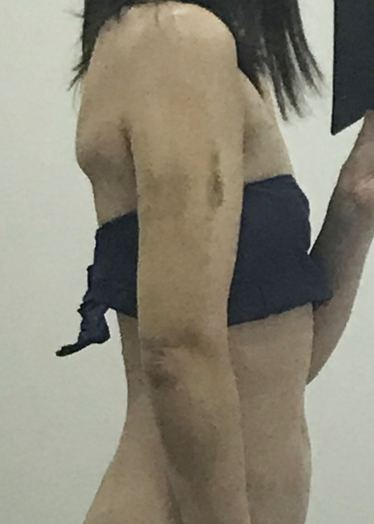 f:id:biyou-daisuki:20180722082410j:plain