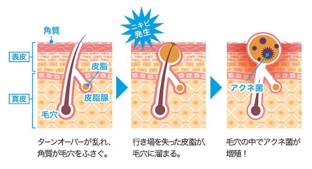 f:id:biyou_jd:20200922221750j:image