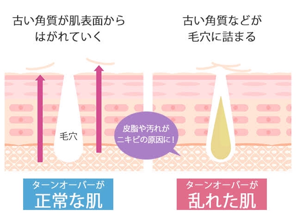 f:id:biyou_jd:20200922224702j:image