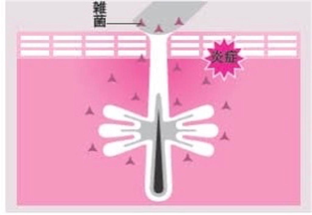 f:id:biyou_jd:20200923233041j:image