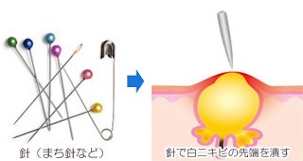 f:id:biyou_jd:20200924074948j:image