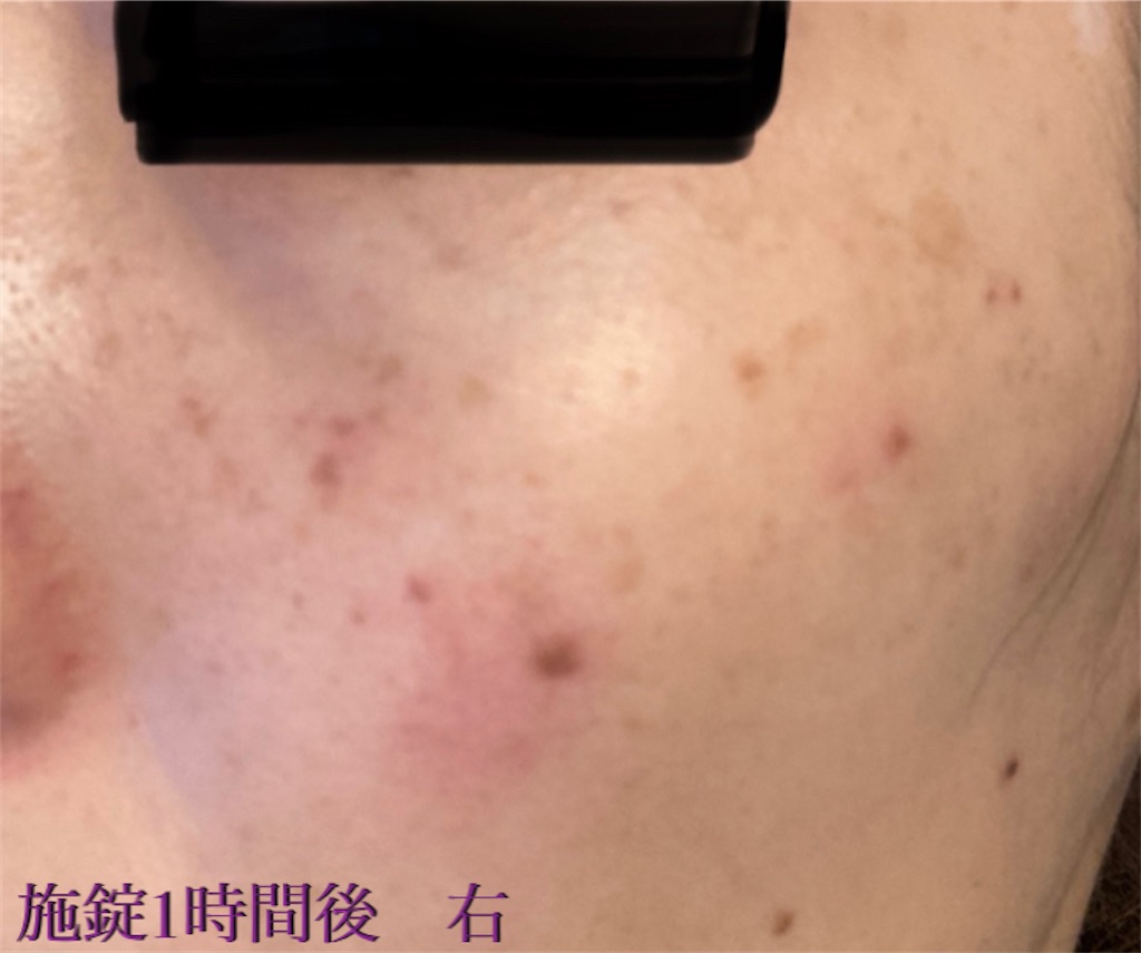 f:id:biyouskin:20211213214508j:image f:id:biyouskin:20211213214508j:image