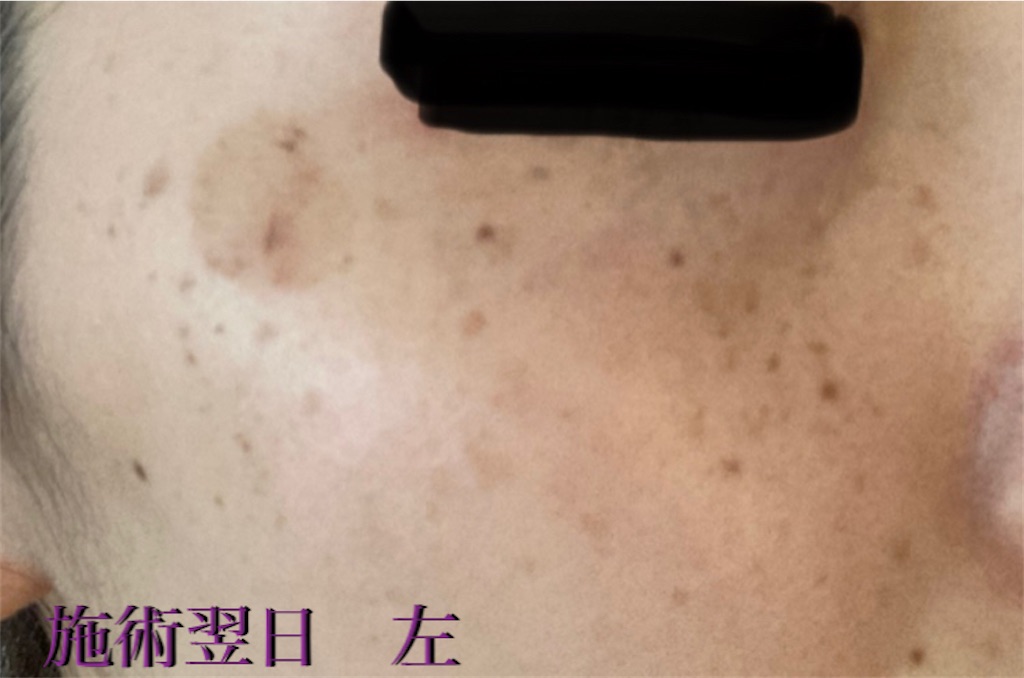 f:id:biyouskin:20211214181455j:image f:id:biyouskin:20211214181455j:image