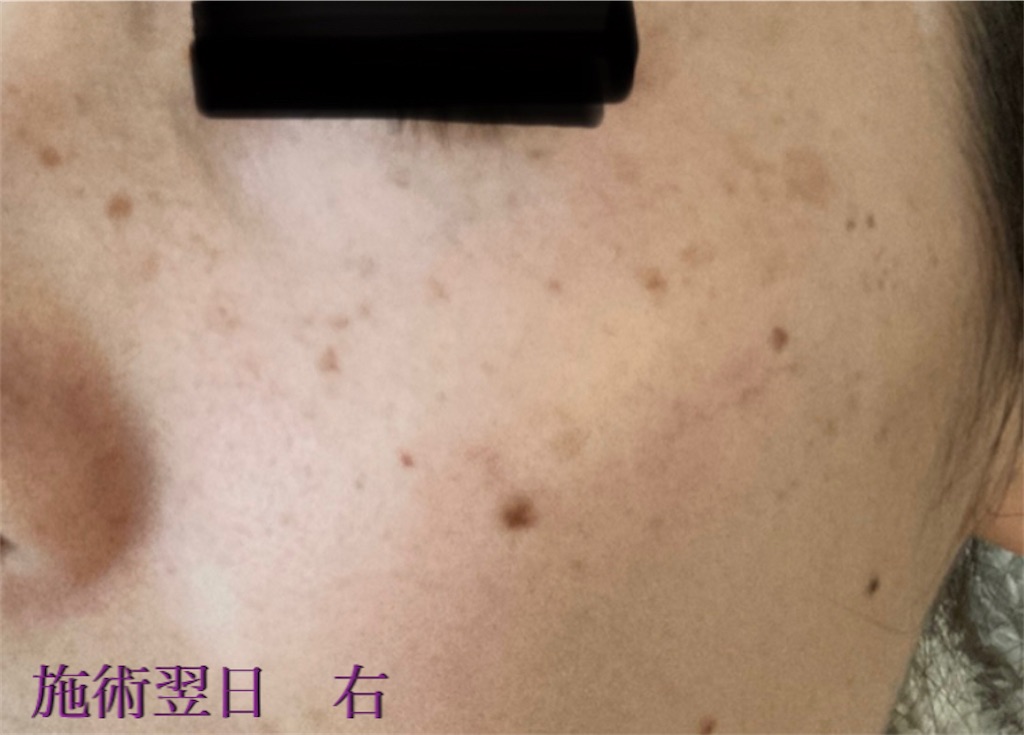 f:id:biyouskin:20211214181457j:image f:id:biyouskin:20211214181457j:image