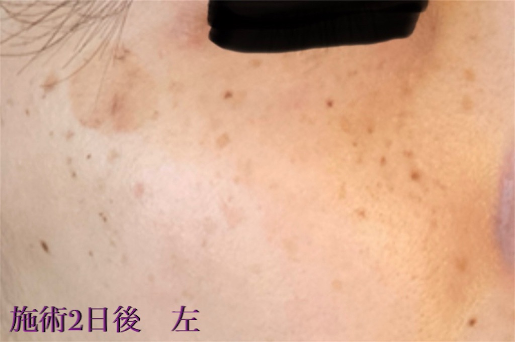 f:id:biyouskin:20211214181915j:image f:id:biyouskin:20211214181915j:image