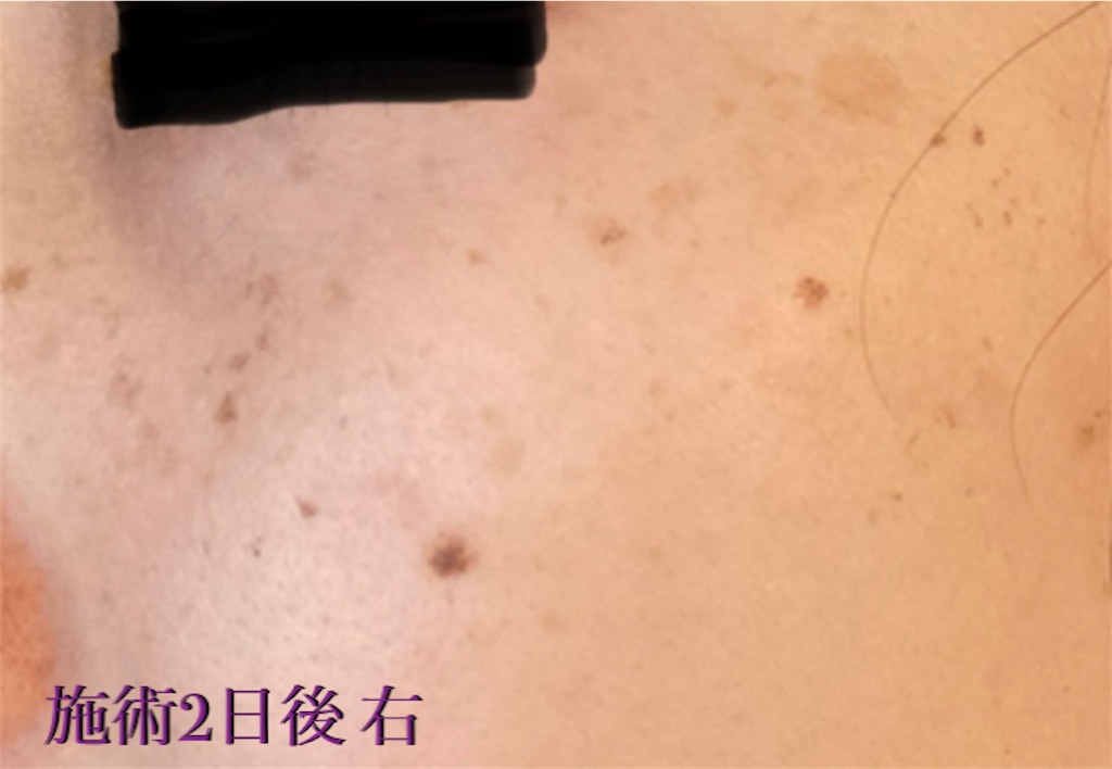 f:id:biyouskin:20211214181918j:image f:id:biyouskin:20211214181918j:image