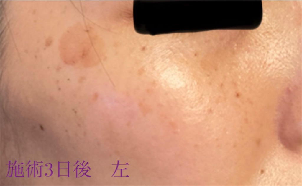 f:id:biyouskin:20211214182528j:image f:id:biyouskin:20211214182528j:image