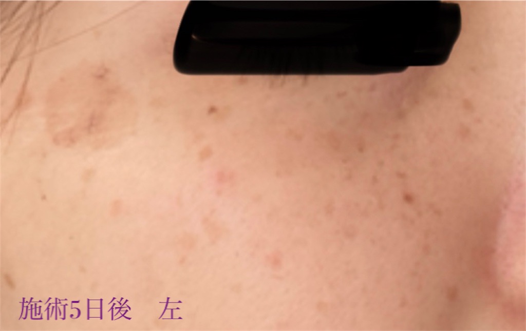 f:id:biyouskin:20211214183245j:image f:id:biyouskin:20211214183245j:image