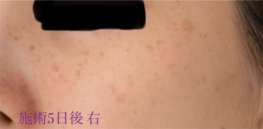 f:id:biyouskin:20211214183247j:image f:id:biyouskin:20211214183247j:image