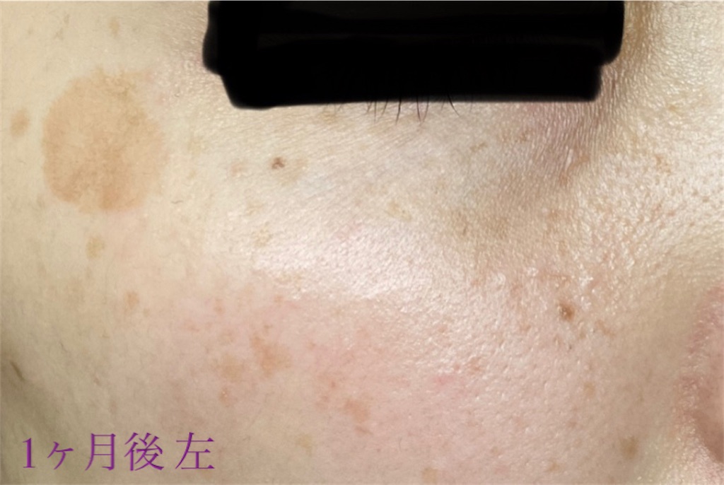 f:id:biyouskin:20211214183736j:image f:id:biyouskin:20211214183736j:image