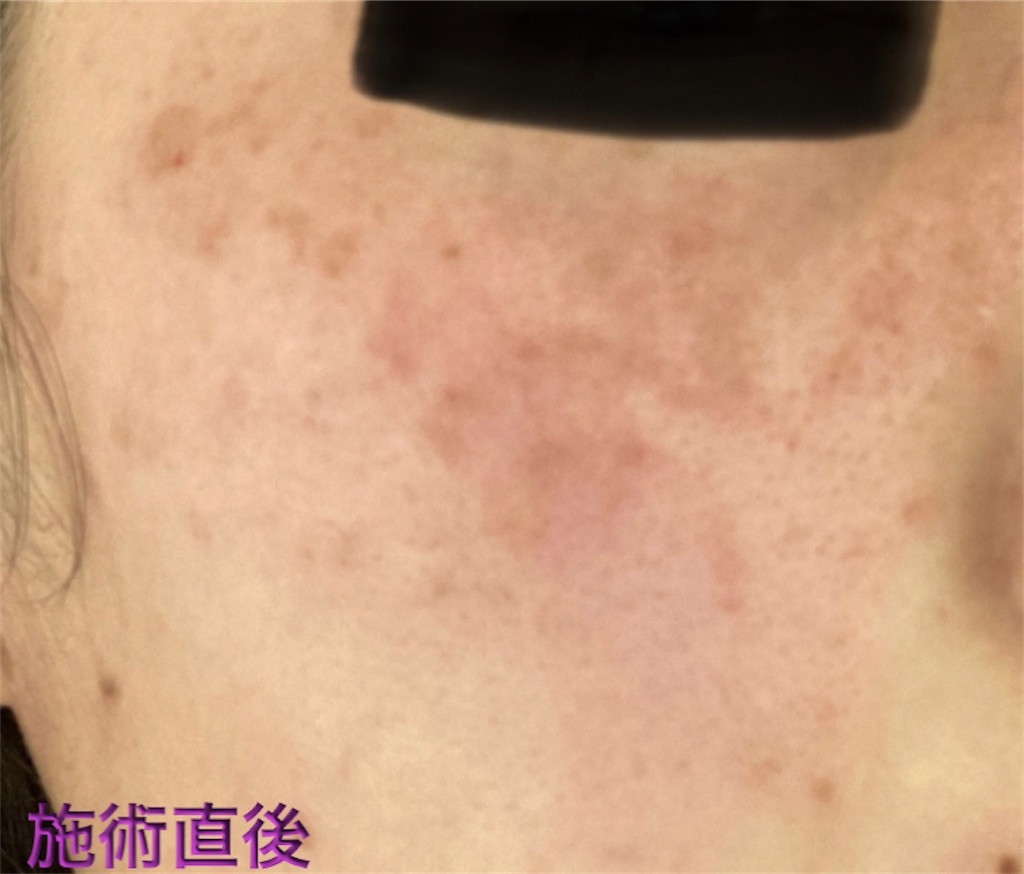 f:id:biyouskin:20211225142740j:image f:id:biyouskin:20211225142740j:image
