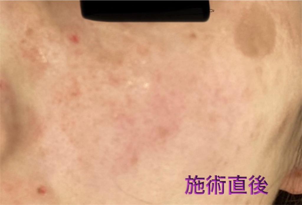 f:id:biyouskin:20211225142742j:image f:id:biyouskin:20211225142742j:image