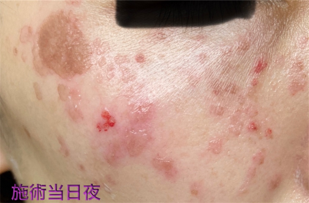 f:id:biyouskin:20211225142917j:image f:id:biyouskin:20211225142917j:image
