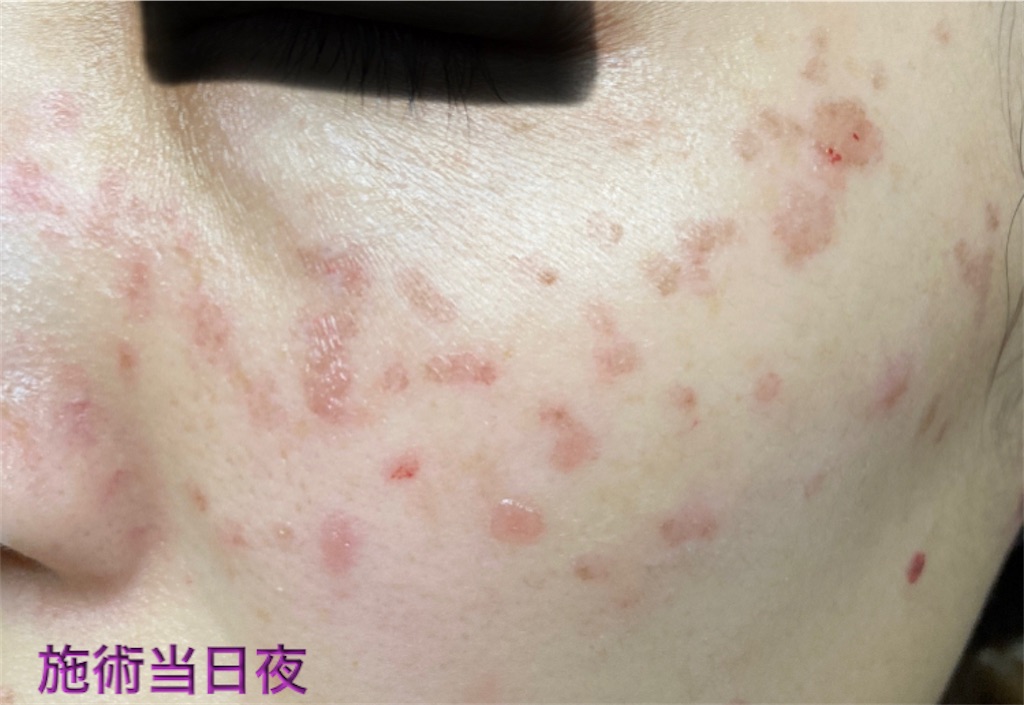 f:id:biyouskin:20211225142920j:image f:id:biyouskin:20211225142920j:image