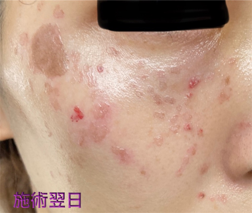 f:id:biyouskin:20211225142941j:image f:id:biyouskin:20211225142941j:image