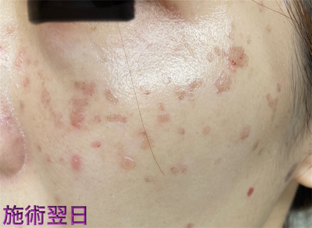 f:id:biyouskin:20211225142944j:image f:id:biyouskin:20211225142944j:image