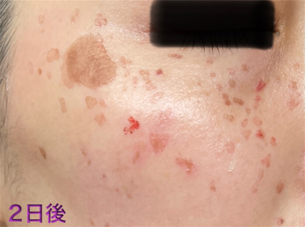 f:id:biyouskin:20211225143023j:image f:id:biyouskin:20211225143023j:image