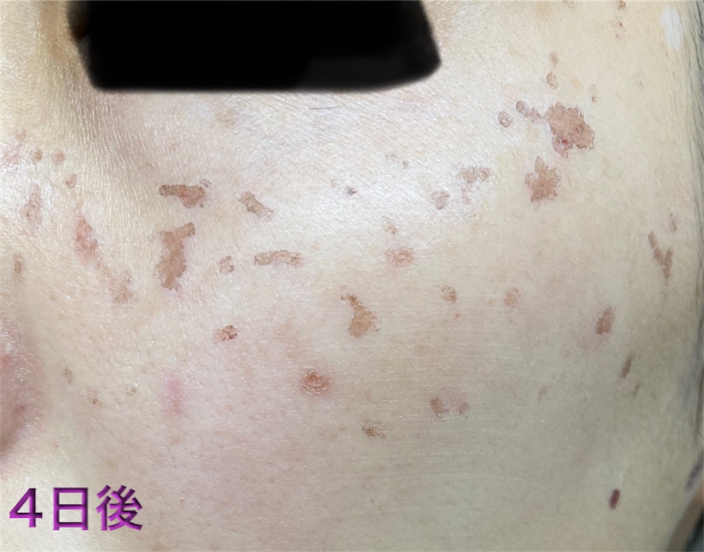 f:id:biyouskin:20211230150441j:image f:id:biyouskin:20211230150441j:image